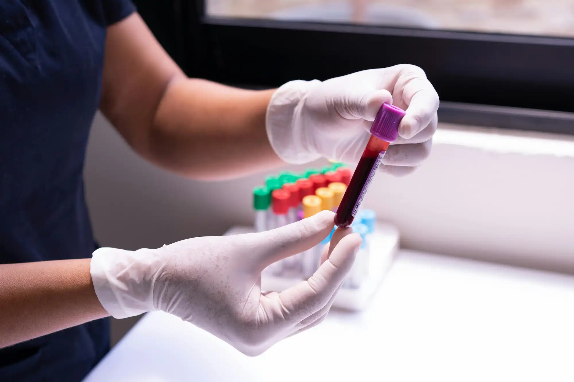 Blood Testing
